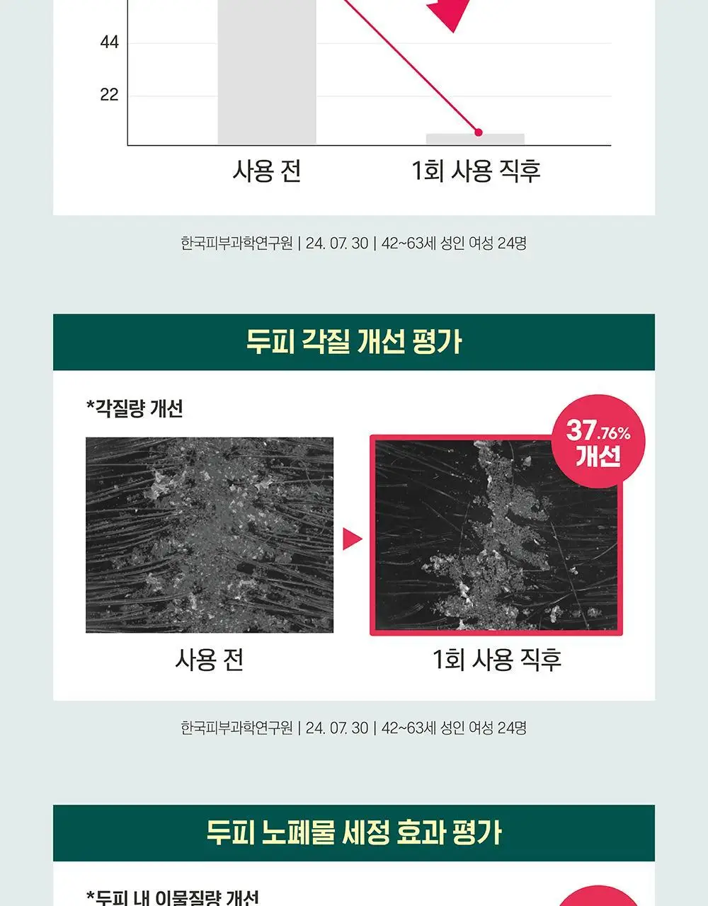 [탈모완화] 라운드랩 소나무 진정 시카 샴푸 400ml 상세페이지 7